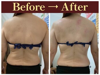 クオレ(CUORE)/ビフォーアフター