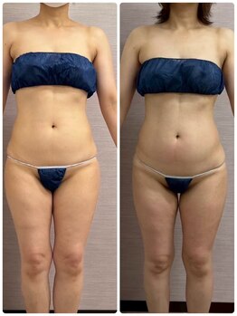 ソフィア わさだ店/40代セルゼロ全身コース10回