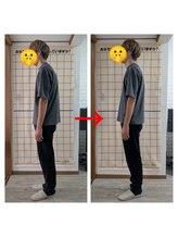カイロプラクティック 楓/猫背、ストレートネック
