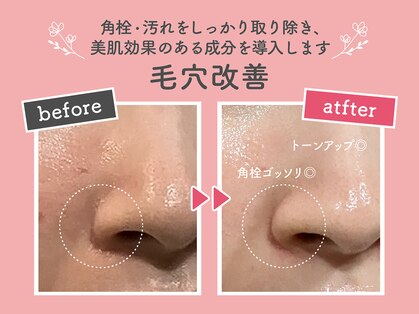 プラリセル(PLa:Recell)の写真