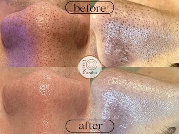 ケアナ 麻布十番店(CareNa)