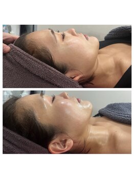 ココ平塚店(COCO)/小顔つくります