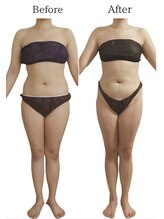 リカバリー(&recovery)/中半身のモタつきrecovery