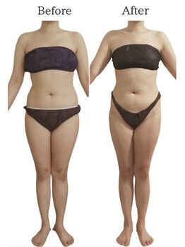 リカバリー(&recovery)/中半身のモタつきrecovery