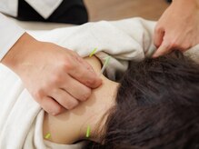 さき鍼灸整骨院