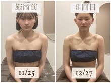 千歳の女神 刈谷店/Before/After