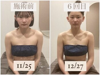 千歳の女神 刈谷店/Before/After