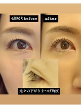 グロウビューティー(grow beauty)/