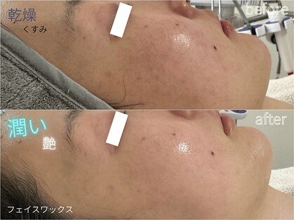 ルーナ 恵比寿(Luna)の写真