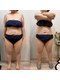 エクリア(Eclia)の写真/夏に間に合わせるなら今!気になる1部位から選べる痩身で気になるコンプレックス解消◎本気の痩身叶えます!