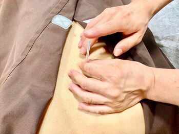 白金高輪はりきゅう整体院/鍼灸施術