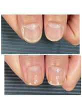 ウェルズユキ(well's yuki)/自爪育成　ネイルケア　違い