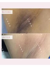 コルザフラワー(charroux flower)/脇