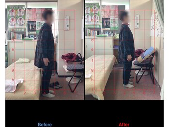 高芝鍼灸整骨院/首の痛み、頭痛