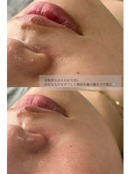 アイルーム ミニョン(eyeroom mignon)/フェイスワックス