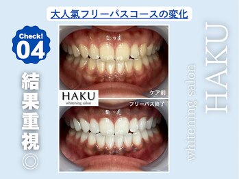 ハク 袋井磐田店(HAKU)/お客様before→after 4