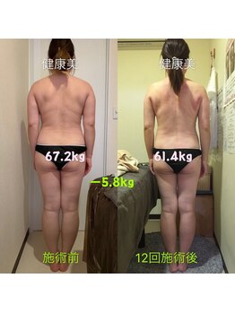 健康美 東洋医学療法院 鴻巣店/魔法のかっさ×美らくる吸引