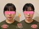 【小顔/リフトアップ/姿勢/骨盤矯正/頭蓋骨/痩身】ヴィオーデ美容整体サロン那覇店の写真