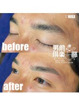 男前倶楽部/脱毛/メンズ脱毛/メンズ専門店