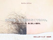 エースター(A-star)