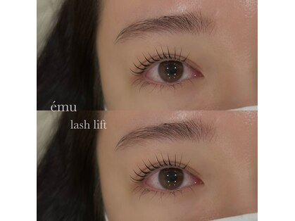 エミュー(emu)の写真