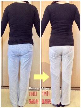 美容整体専門院 新美選/スタイルアップ整体 変化写真