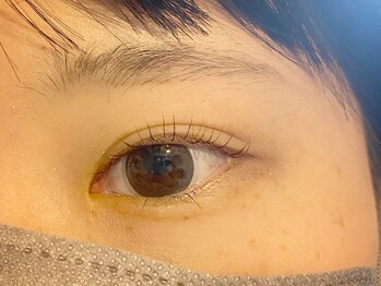 フェルナ(FERNA)/ラッシュリフトであげる