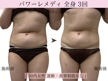 ラエッセ(La Esse)/お腹スッキリ!筋膜リリース