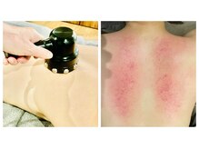 シャムリー 並木坂(Syamry)/肩こり・脂肪ケア・背中