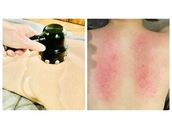 シャムリー 並木坂(Syamry)/肩こり・脂肪ケア・背中