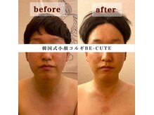 ビーキュート 渋谷北参道店(BE-CUTE)/Before・After 施術
