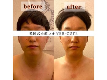 ビーキュート 渋谷北参道店(BE-CUTE)/Before・After 施術