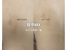 ルナソルビューティーサロン 浜松店(Lunasol)/背中 MIX脱毛♪