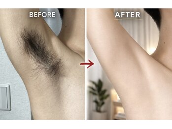 ヨハク(YOHAKU)/30代前半 &nbsp;男性 &nbsp;10回施術