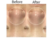 ベベ 高崎本店(Be'be')の雰囲気(黒ずみ/詰まり/開き…毛穴悩みは毛穴専門店で改善)