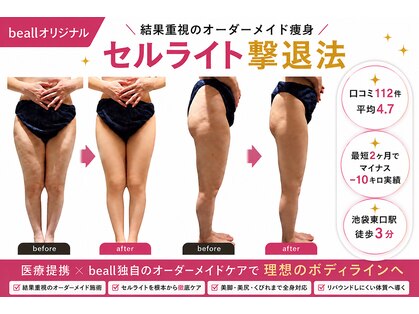 ビオール 池袋店(beall)の写真