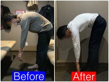 ナオル整体 仙台院(NAORU整体)/30代男性「腰痛」