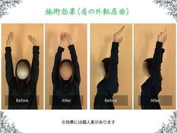 ボディ リセット アンド デザイン(Body Reset & Design)/【施術例】ビフォーアフター