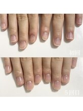 クレア(clea)/ネイルケア【浜松/ネイル】