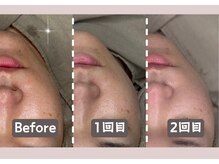 シー センター北(sii)/くすみ知らずのクリアな肌へ