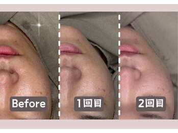 シー センター北(sii)/くすみ知らずのクリアな肌へ