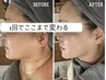 小顔人気NO1【ー3Kg痩せ見え・輪郭チェンジ速実感】お悩み全部アプローチ