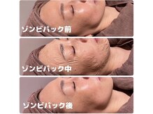 ビューティーフェイスグランデ 船橋店(Beauty Face GRANDE)/ゾンビマスク