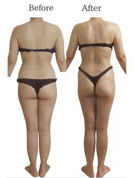 リカバリー(&recovery)/中半身のモタつきrecovery