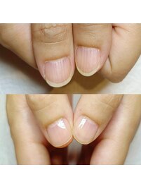 ネイルケア足りてる？自爪育成