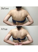 アルディート(Ardito)/筋膜リリース上半身60分コース