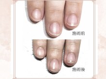 フルリー(Fleurir)の雰囲気（お爪の状態に合わせて、お手入れさせていただきます。）