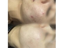 ホワイトリフト 浜松店(WHITE LIFT)の雰囲気（「キレイを阻むサイン」をサロンケア×ホームケアで取り除きます）