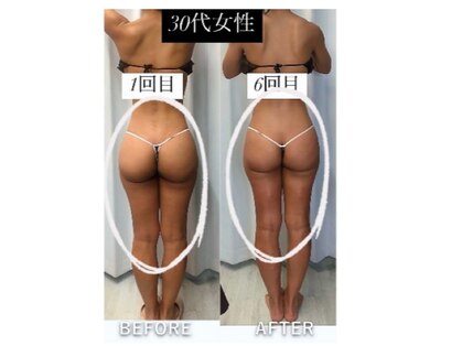 レチカ(Rechica)の写真