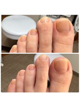 あし処 トコトコ(tocotoco)/キレイな足もより美しく